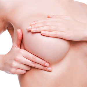BREAST LIFT WITH IMPLANTS